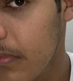 Abod, 20 jaar oud, Man